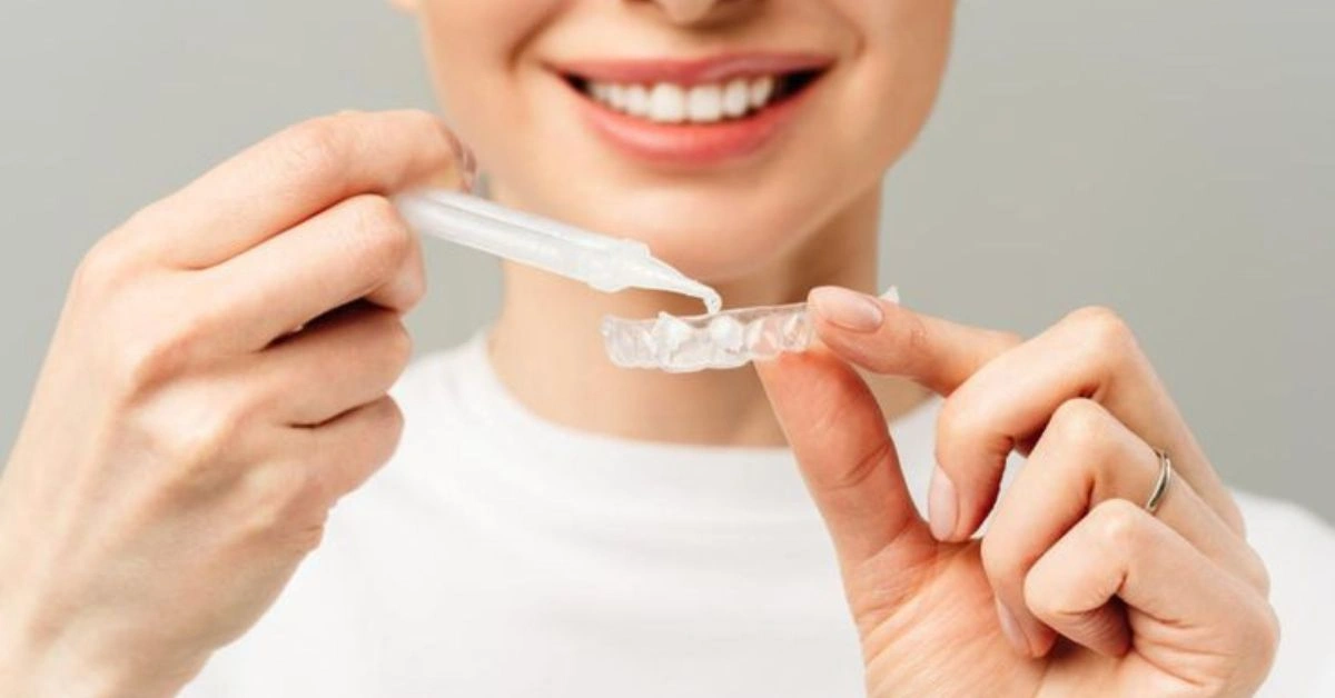 Best At-Home Teeth Whitening Kits 2026